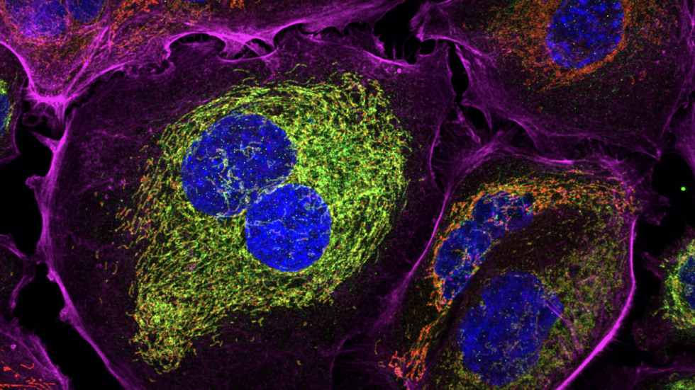 Captured in Mitosis: The Effects of Paclitaxel on Ovarian Cancer Cells by Basel White
