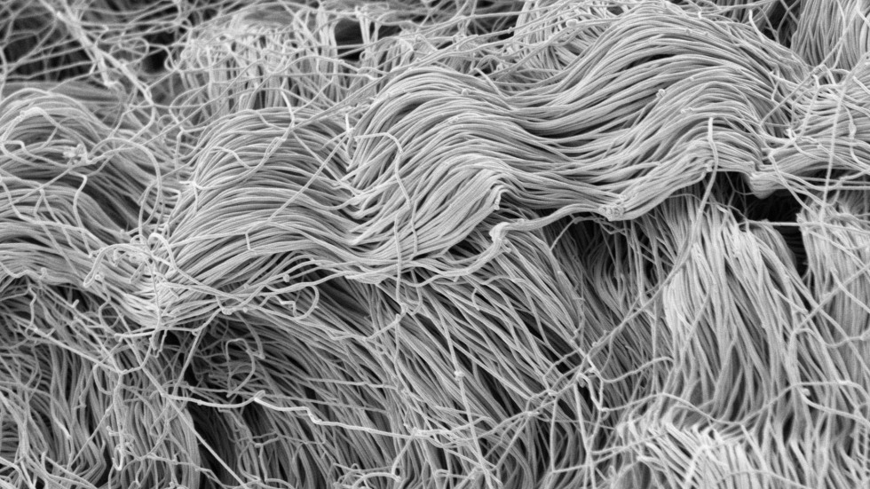 Frog Sartorius Epimysial Cable by Emily McParland