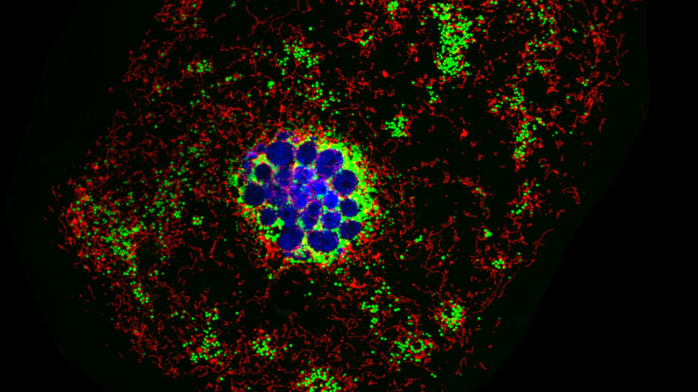 Polyploid Giant Cell Feeding on Lipids by Gavin Lu